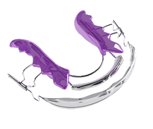 inman aligner 3D model