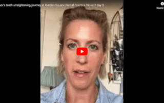 Eleanor’s teeth straightening journey at Garden Square Dental Practice Image