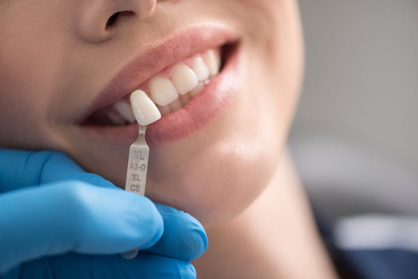 Dental Implants West London Image