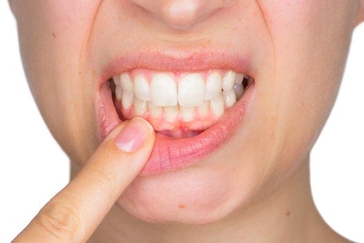 Gum disease treatments west london image