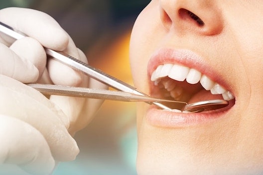 Periodontist Bayswater West London Image