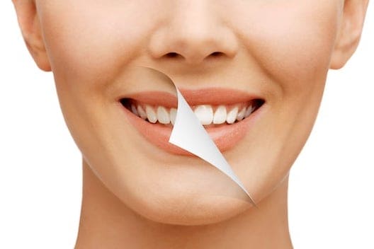 Teeth Whitening West London Image