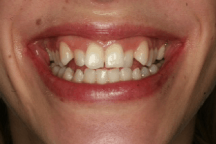 Orthodontic case study 1 Image 2