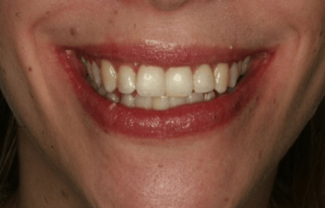 Orthodontic case study 1 Image 2