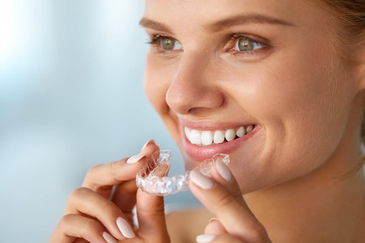 Straightening Your Teeth with Clear Aligners image