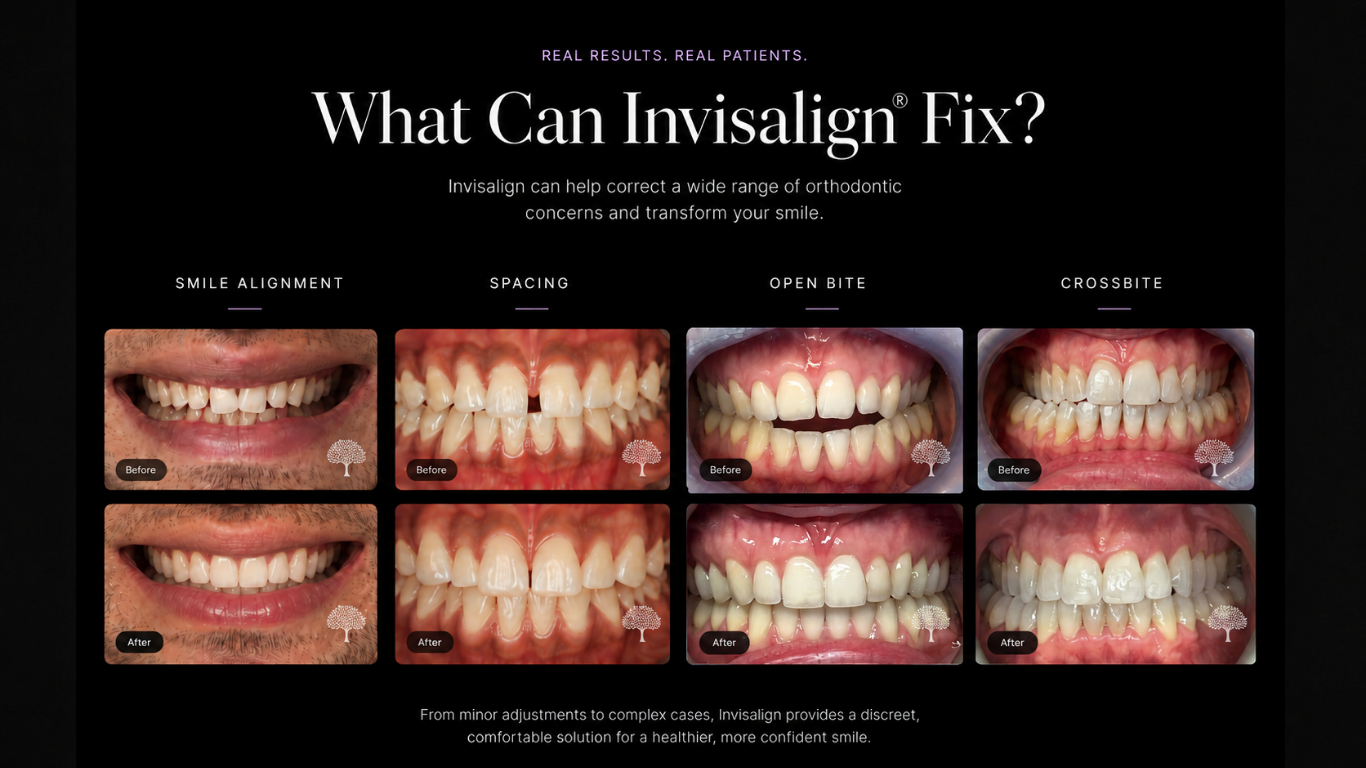 Invisalign case study – hero page card v4