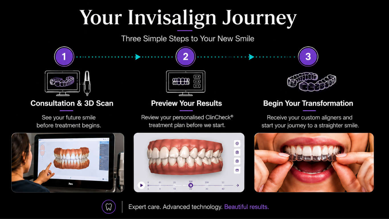Invisalign journey card (2)